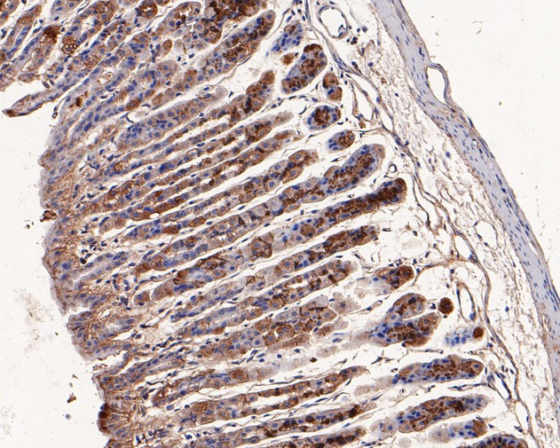 LIPF Antibody in Immunohistochemistry (Paraffin) (IHC (P))