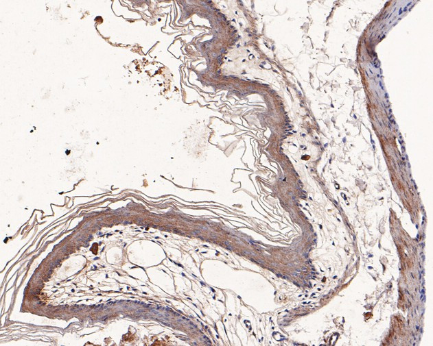 LIPF Antibody in Immunohistochemistry (Paraffin) (IHC (P))