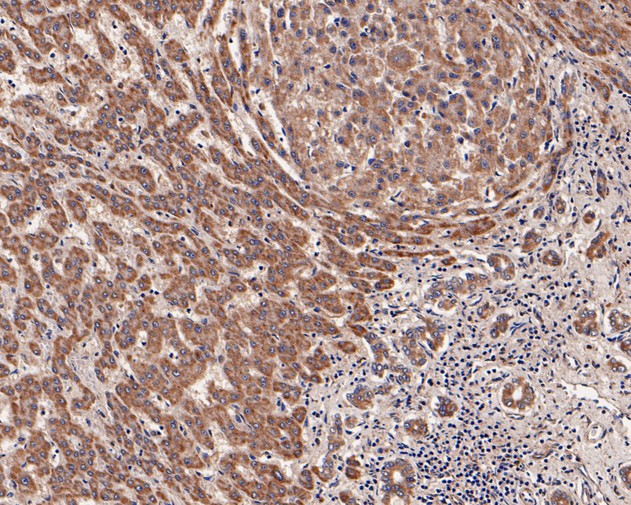 LIPF Antibody in Immunohistochemistry (Paraffin) (IHC (P))