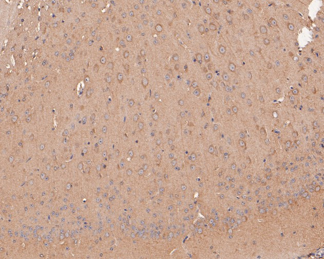 GABA A Receptor beta 3 Antibody in Immunohistochemistry (Paraffin) (IHC (P))