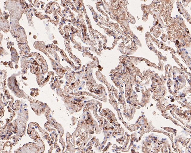 GABA A Receptor beta 3 Antibody in Immunohistochemistry (Paraffin) (IHC (P))