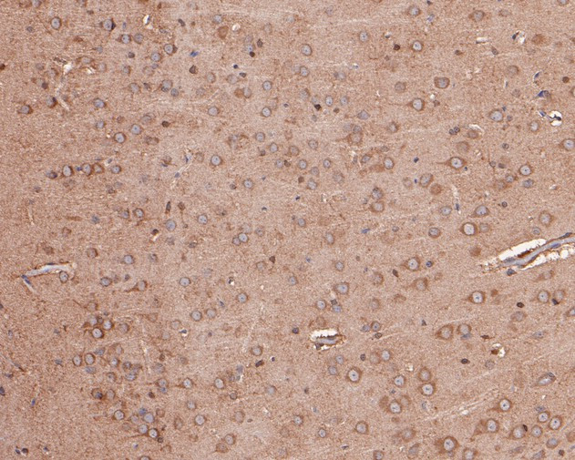 GABA A Receptor beta 3 Antibody in Immunohistochemistry (Paraffin) (IHC (P))