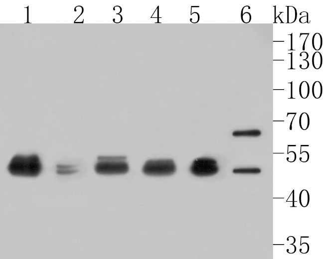 GABA A Receptor beta 3 Antibody in Western Blot (WB)