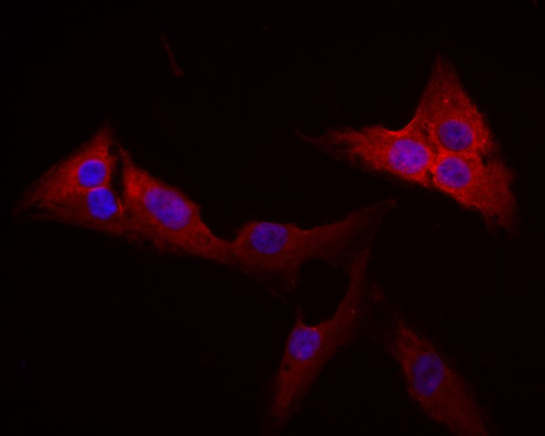 Activin Receptor Type IA Antibody in Immunocytochemistry (ICC/IF)