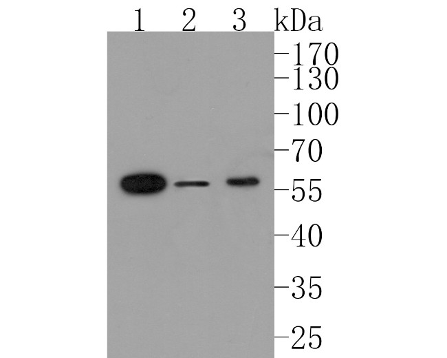 Activin Receptor Type IA Antibody in Western Blot (WB)