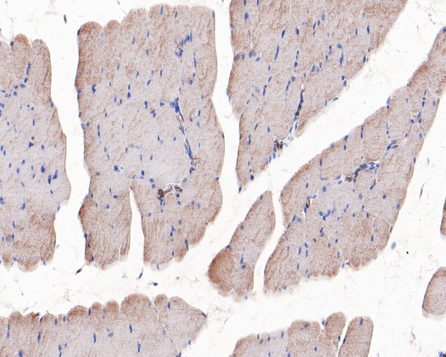 UCP1 Antibody in Immunohistochemistry (Paraffin) (IHC (P))