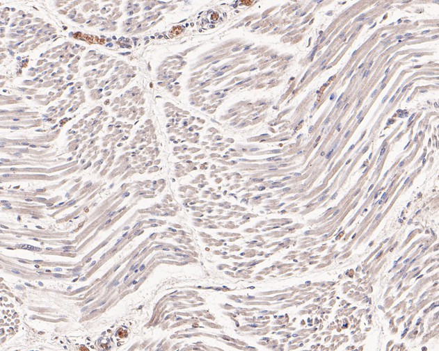 UCP1 Antibody in Immunohistochemistry (Paraffin) (IHC (P))