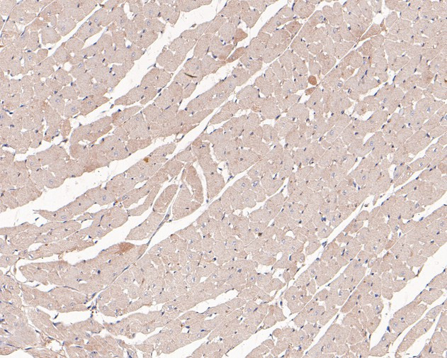 UCP1 Antibody in Immunohistochemistry (Paraffin) (IHC (P))