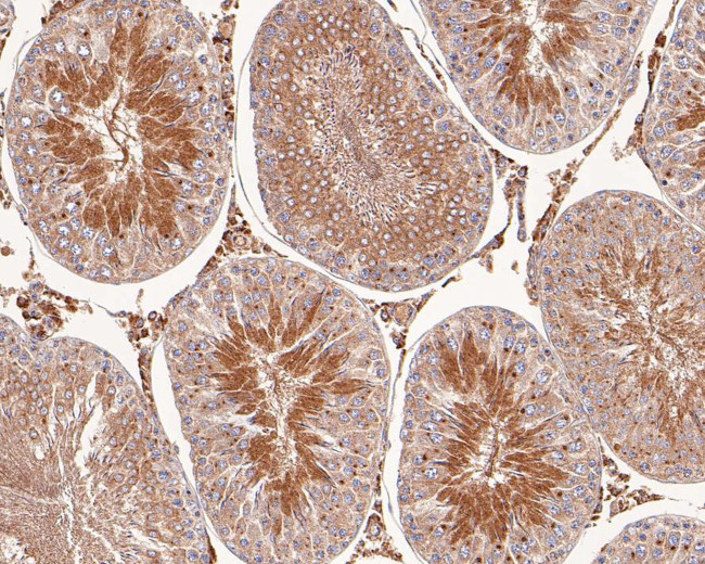 LKB1 Antibody in Immunohistochemistry (Paraffin) (IHC (P))