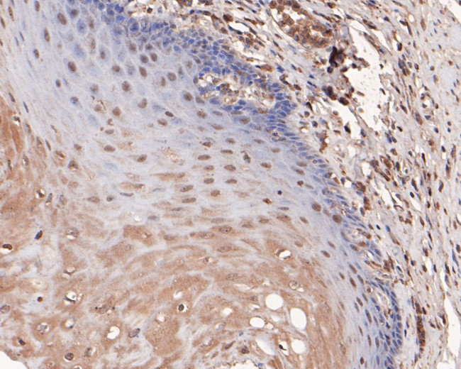 CDKN1A/P21 Antibody in Immunohistochemistry (Paraffin) (IHC (P))