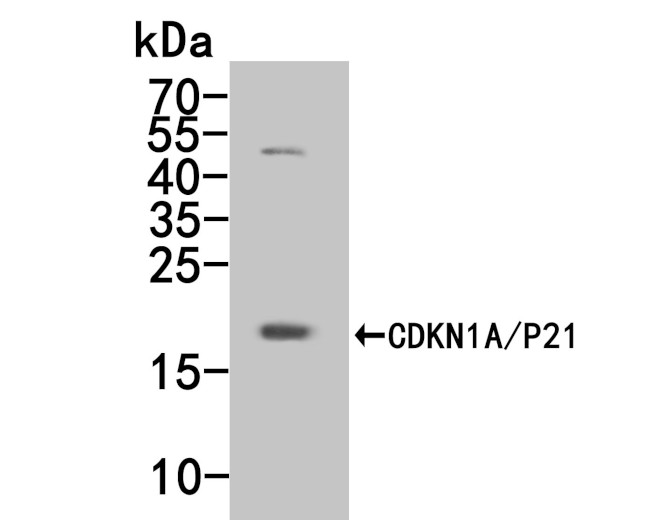 CDKN1A/P21 Antibody in Western Blot (WB)