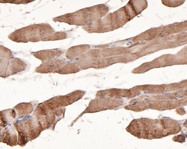 PPP2R1A Antibody in Immunohistochemistry (Paraffin) (IHC (P))