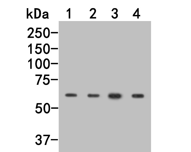 PPP2R1A Antibody in Western Blot (WB)