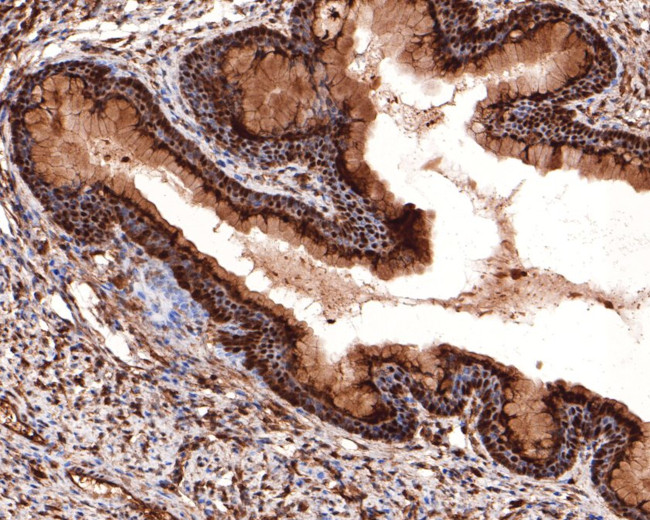 SF3A1 Antibody in Immunohistochemistry (Paraffin) (IHC (P))