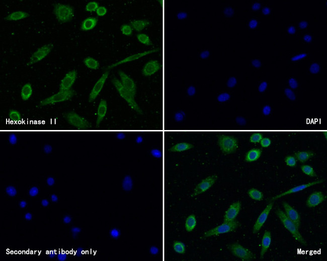 Hexokinase II Antibody in Immunocytochemistry (ICC/IF)