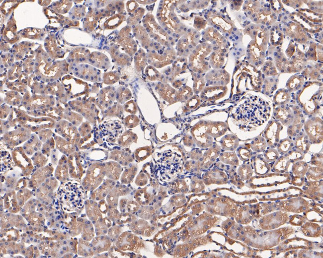 Hexokinase II Antibody in Immunohistochemistry (Paraffin) (IHC (P))