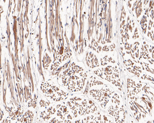 Hexokinase II Antibody in Immunohistochemistry (Paraffin) (IHC (P))