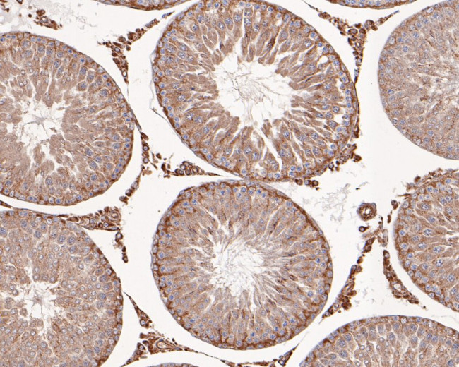 Hexokinase II Antibody in Immunohistochemistry (Paraffin) (IHC (P))