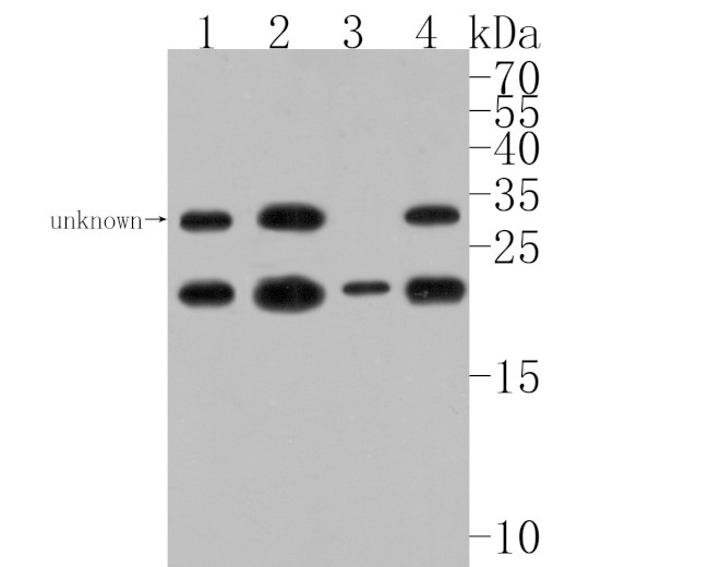 TCF21 Antibody in Western Blot (WB)