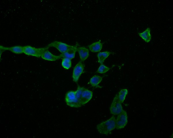 Myelin PLP Antibody in Immunocytochemistry (ICC/IF)