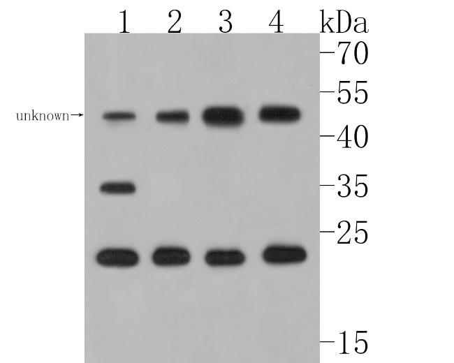 Myelin PLP Antibody in Western Blot (WB)