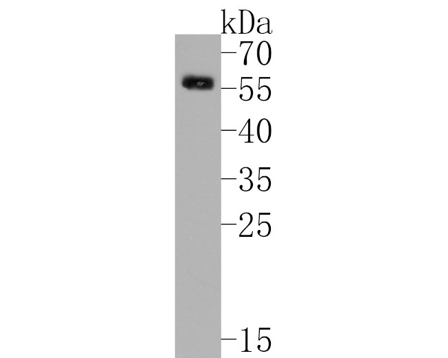 GLP-1R Antibody in Western Blot (WB)