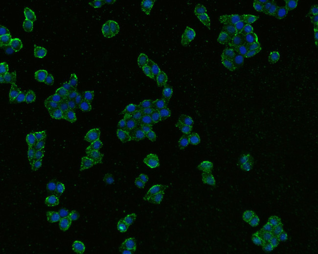 Cannabinoid Receptor I Antibody in Immunocytochemistry (ICC/IF)