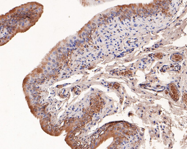 Cannabinoid Receptor I Antibody in Immunohistochemistry (Paraffin) (IHC (P))