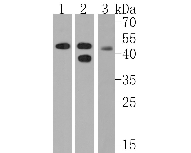 Cannabinoid Receptor I Antibody in Western Blot (WB)