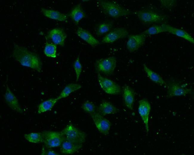 NMDAR2B Antibody in Immunocytochemistry (ICC/IF)