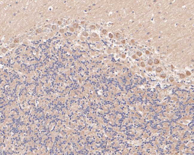 NMDAR2B Antibody in Immunohistochemistry (Paraffin) (IHC (P))