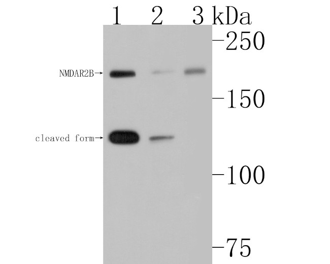 NMDAR2B Antibody in Western Blot (WB)