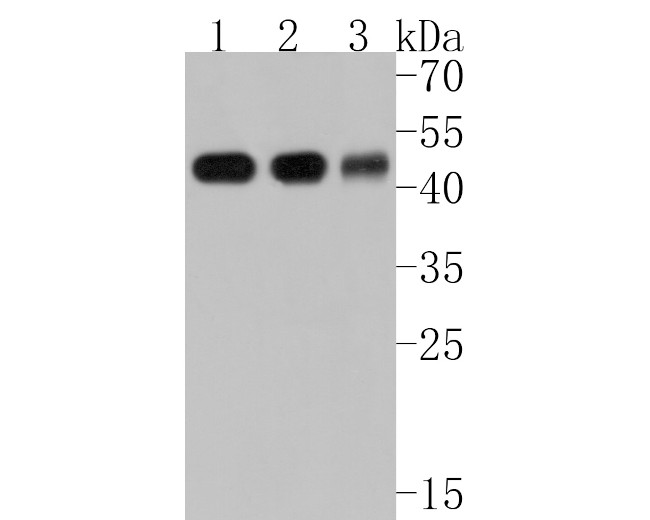 MAT1A Antibody in Western Blot (WB)