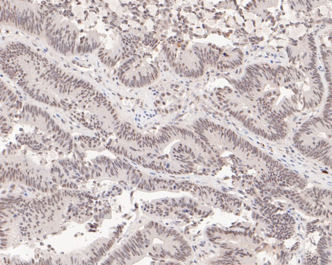 SF3A1 Antibody in Immunohistochemistry (Paraffin) (IHC (P))