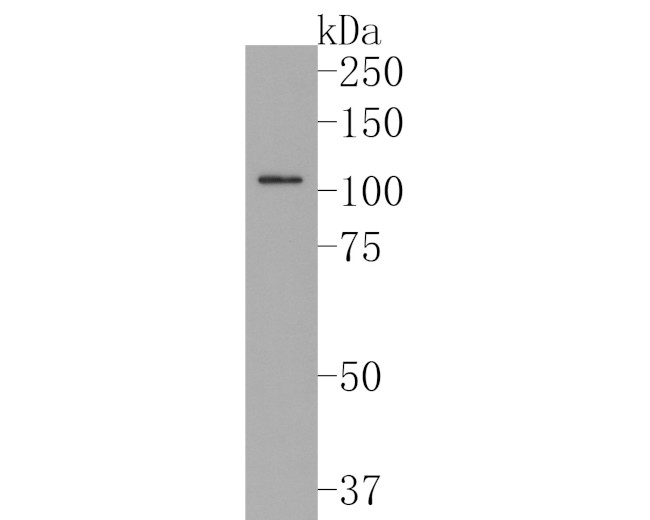 SF3A1 Antibody in Western Blot (WB)