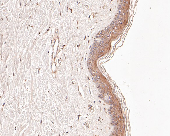 Butyrylcholine esterase Antibody in Immunohistochemistry (Paraffin) (IHC (P))