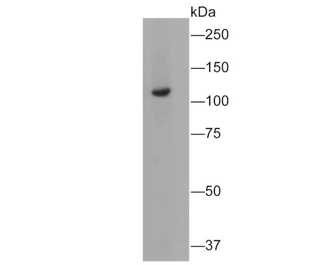 Butyrylcholine esterase Antibody in Western Blot (WB)