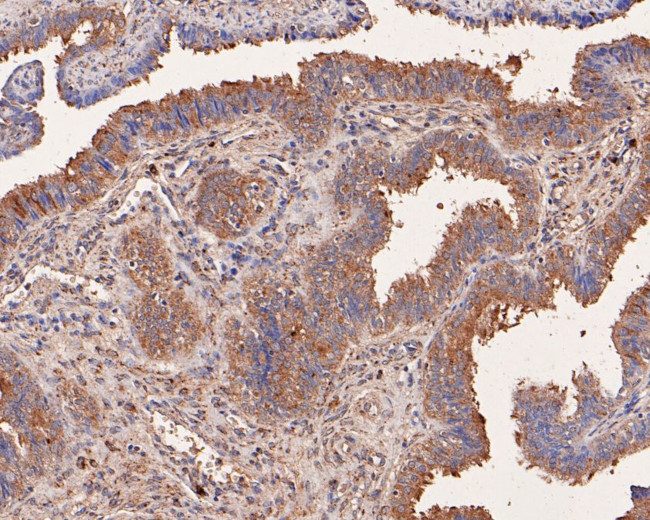 NMBR Antibody in Immunohistochemistry (Paraffin) (IHC (P))