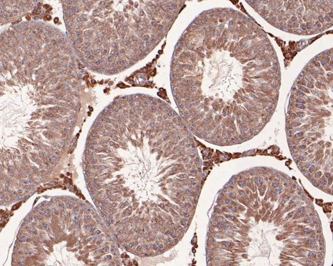 NMBR Antibody in Immunohistochemistry (Paraffin) (IHC (P))