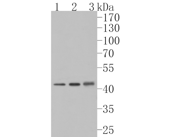 NMBR Antibody in Western Blot (WB)