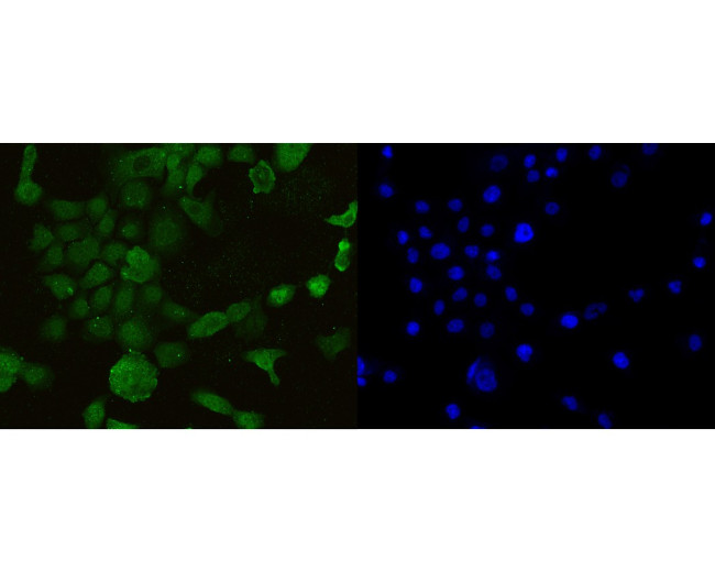 AIM2 Antibody in Immunocytochemistry (ICC/IF)