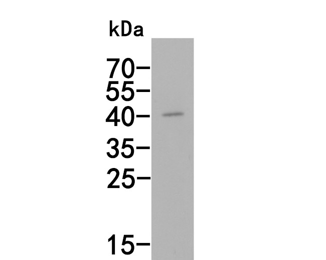 AIM2 Antibody in Western Blot (WB)