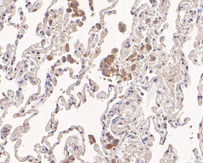 MVD Antibody in Immunohistochemistry (Paraffin) (IHC (P))