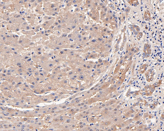 MVD Antibody in Immunohistochemistry (Paraffin) (IHC (P))