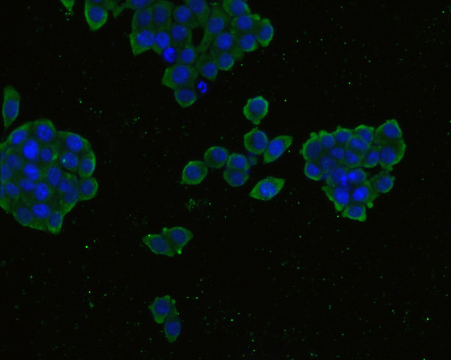 CCR3 Antibody in Immunocytochemistry (ICC/IF)