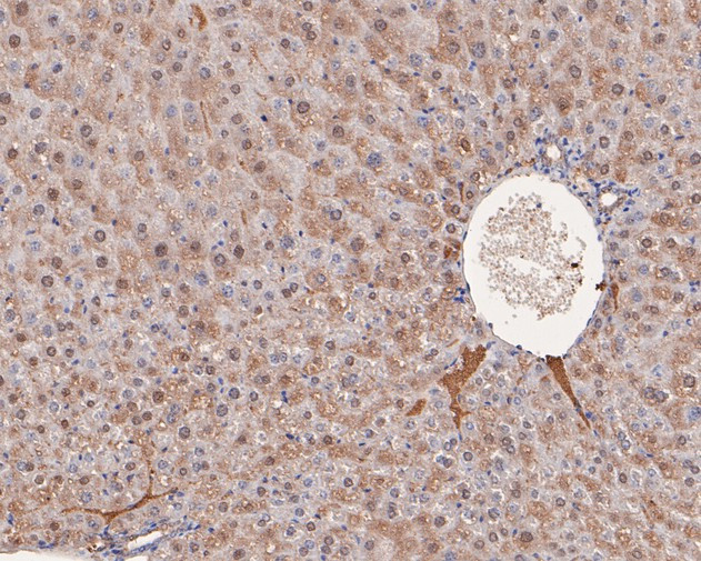 Triosephosphate isomerase Antibody in Immunohistochemistry (Paraffin) (IHC (P))