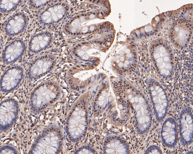 Triosephosphate isomerase Antibody in Immunohistochemistry (Paraffin) (IHC (P))