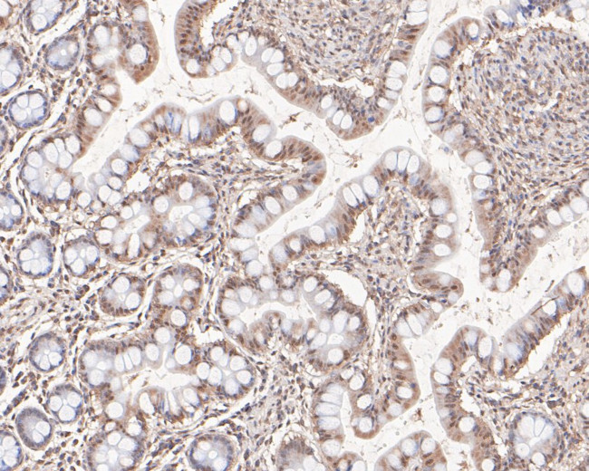 HNF1 alpha Antibody in Immunohistochemistry (Paraffin) (IHC (P))