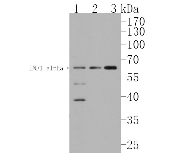 HNF1 alpha Antibody in Western Blot (WB)