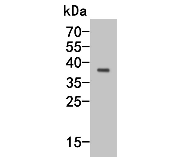 GNAI2 Antibody in Western Blot (WB)